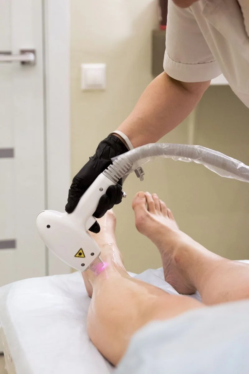 Laser Hair Removal